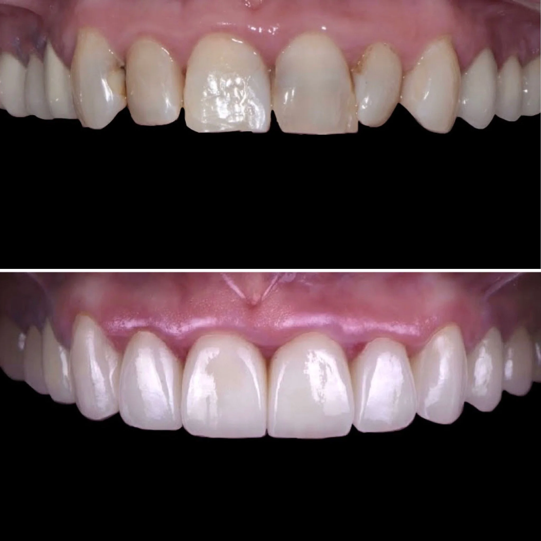 PC Before and After.JPG