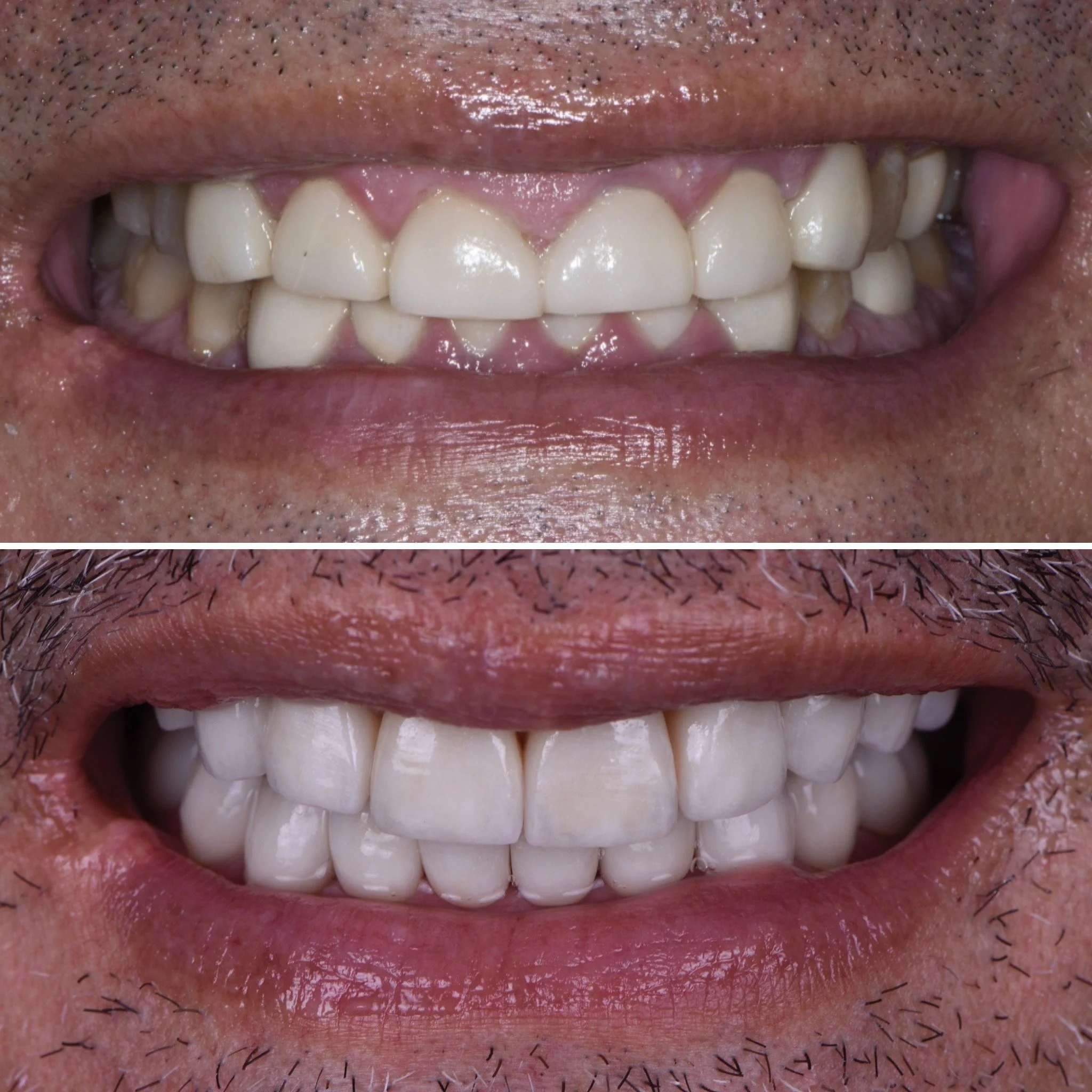 JM Before and After.JPG