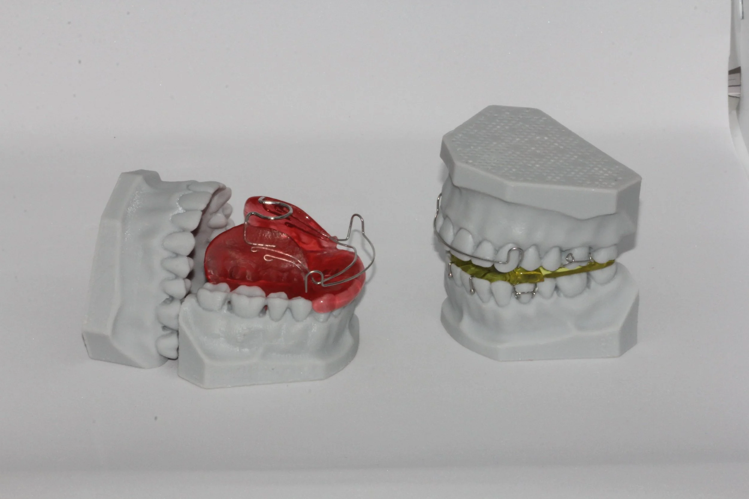 Appliances — A Point Dental Lab