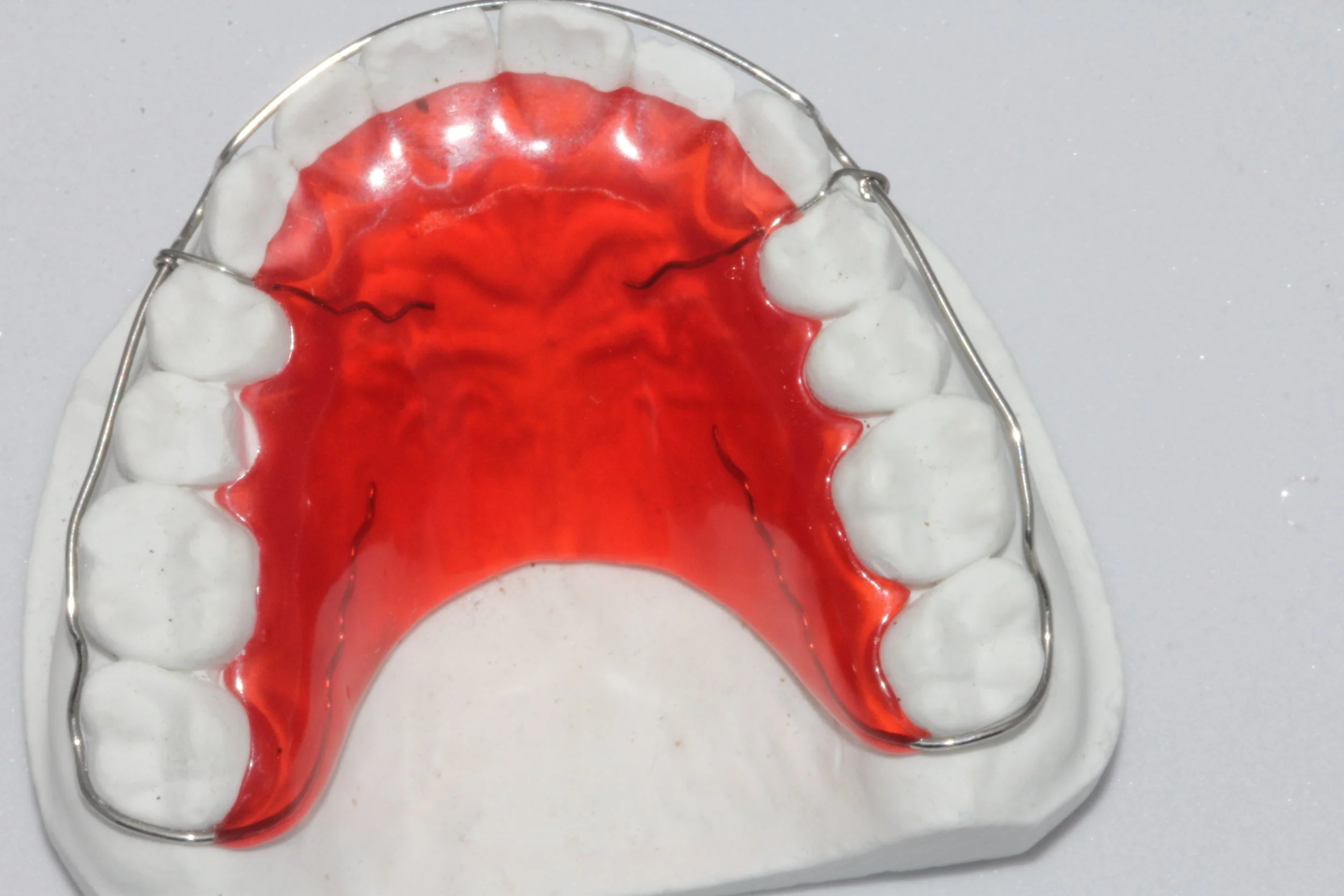 Appliances — A Point Dental Lab