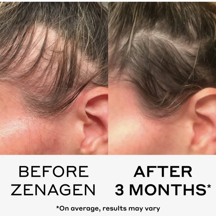 9 month supply, thickening and growth shampoo treatment and conditioner. 