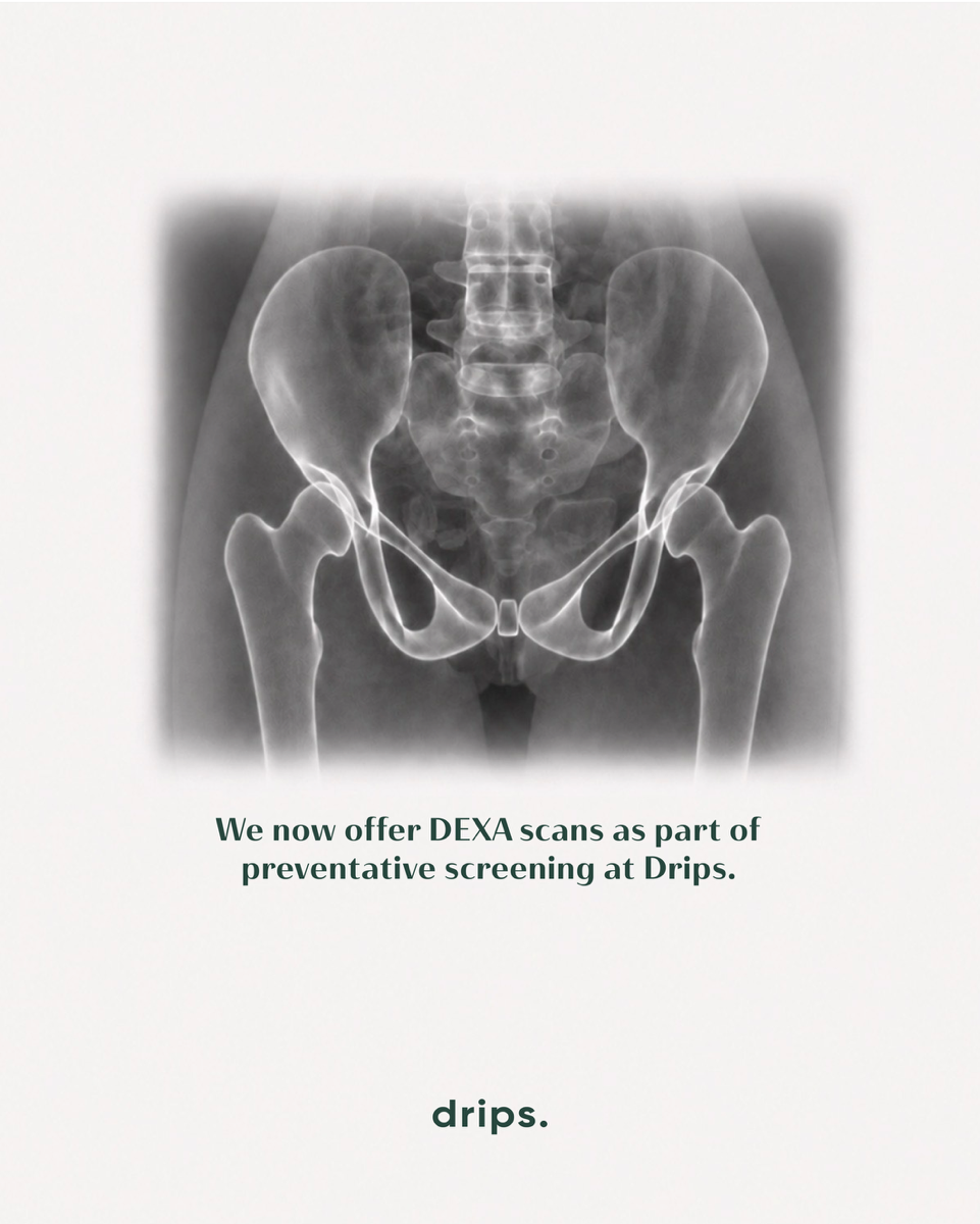 DEXA Scan for Longevity: When Optional Data Becomes Essential