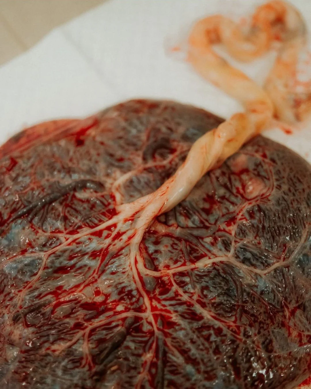 The Tree of Life 🌿 Often unseen, always extraordinary. 
 
The placenta sustains, nurtures, and protects.

Every vessel, every vein tells the story of growth and connection. Its a bridge between two hearts. What a miracle it is to see where life begi