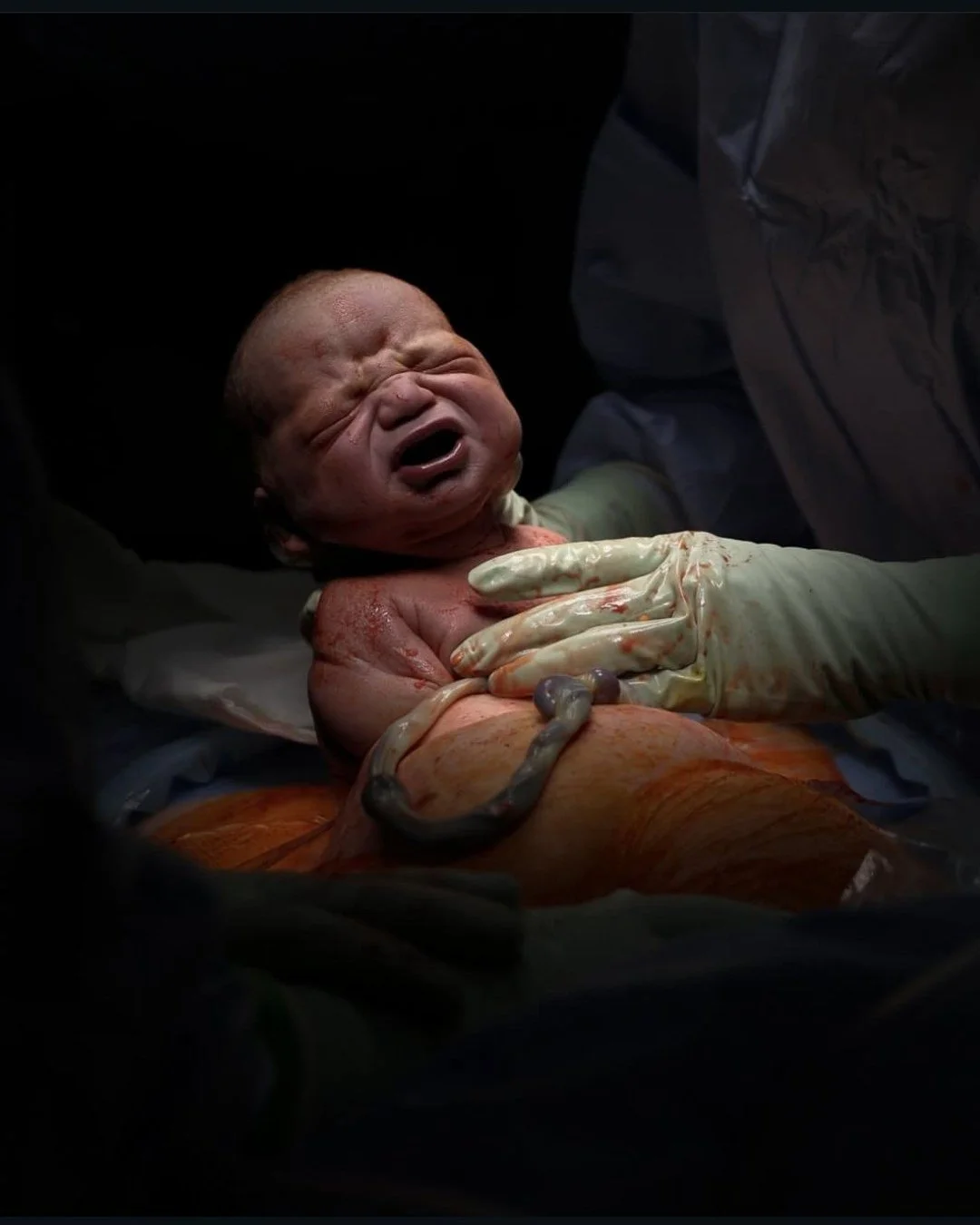 There are few moments in this world as powerful as a baby&rsquo;s first breath.

That first cry - raw, pure, and full of life - fills the room with emotion and awe. In that instant, every heartbeat, every contraction, every moment of anticipation fin