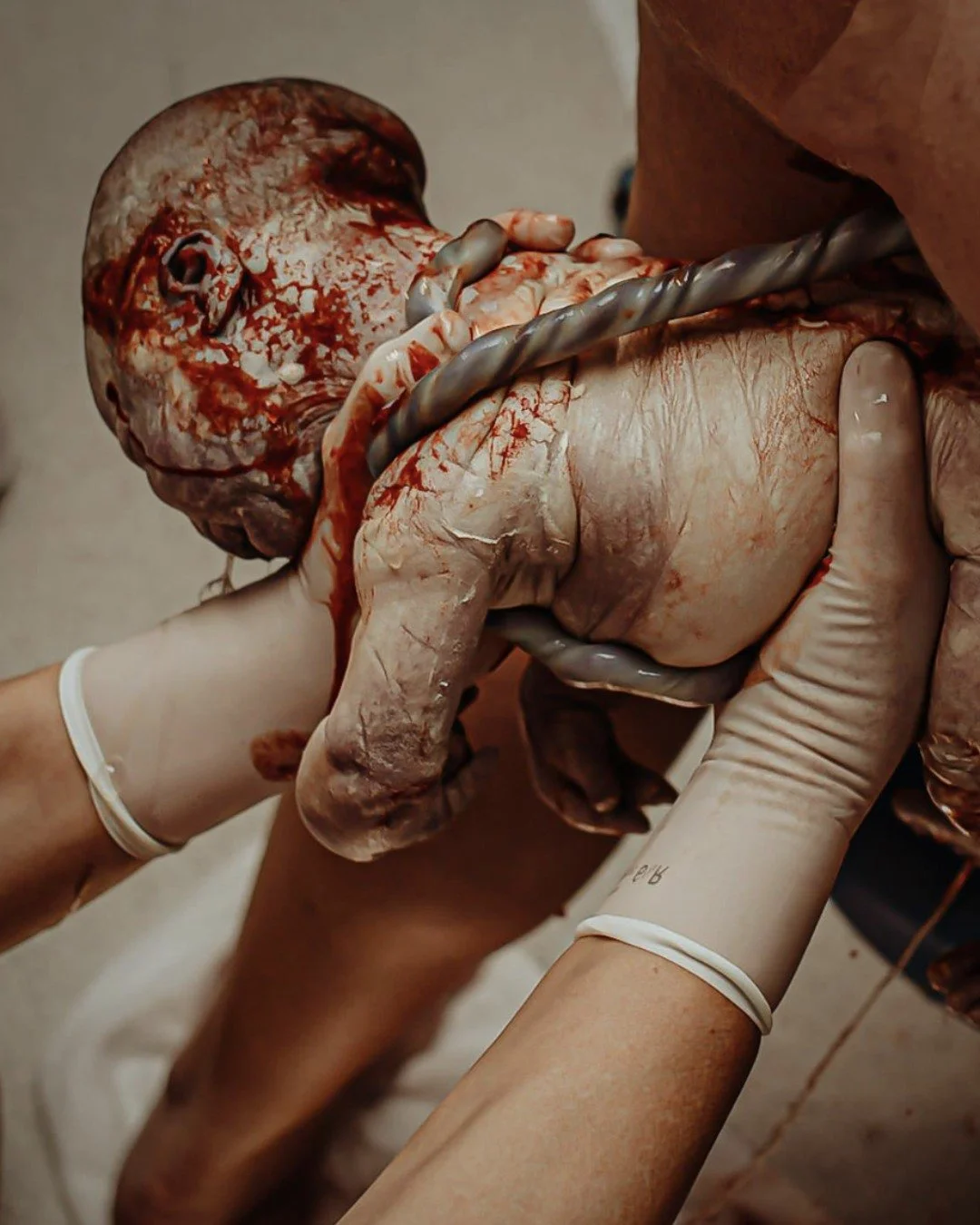 A bridge between two worlds ✨

The umbilical cord - nature&rsquo;s perfect design - delivering life from one heart to another.
Still vibrant, still full of purpose, even in this moment of transition.
The beauty of birth, raw and real. 🌿

📸 @tiarnec