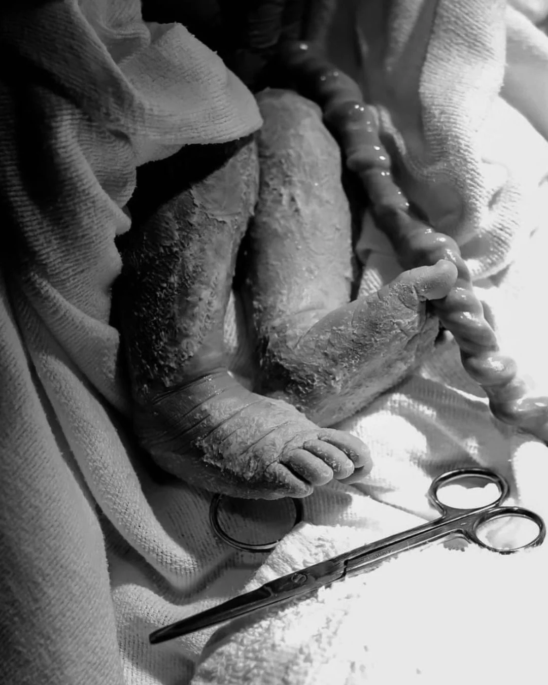 From the very first moments, your baby is full of wonder. 💛 The umbilical cord may be small, but it played a huge role in bringing your little one safely into the world.

📸 @the_birthkeeper 

#NewbornHealth #PostnatalCare #MidwifeAlex