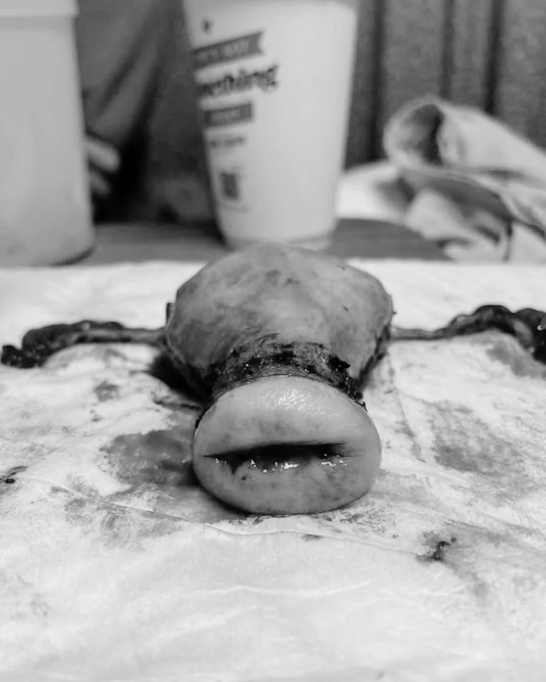 The uterus is a quiet miracle 🌿

It grows, stretches, and holds life with unwavering strength. From a tiny pear-sized organ to a vessel that nurtures a full-term baby, placenta, and fluid, it is a cradle of love. 💛

It remembers, it heals, it contr