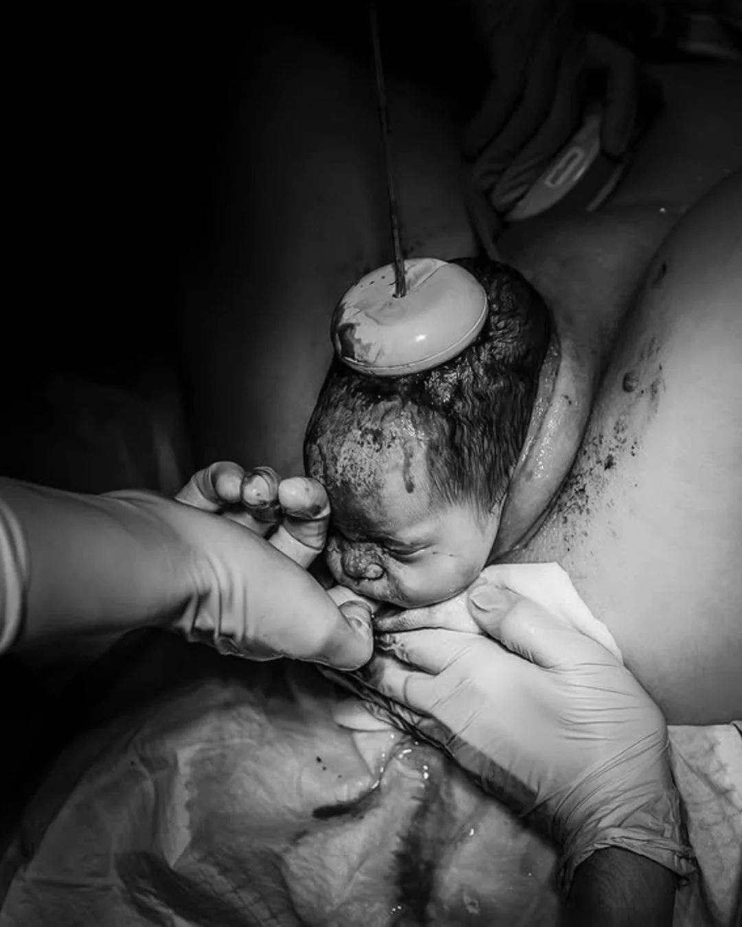 There is power in softness.
Strength in surrender.
And love in every breath.

This moment doesn&rsquo;t need words, just presence, trust, and deep connection.

Birth, exactly as it is meant to be. 🤍

📷 @marthagracebirthphotography 

#BirthMoment #S