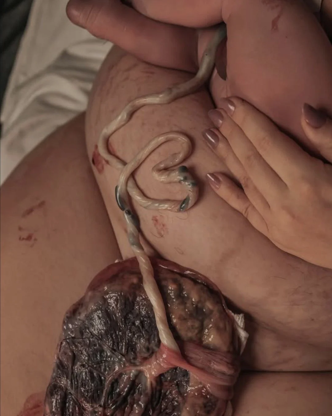 Most people look away from this part.

But I think it deserves to be seen.

This is the placenta - the organ your body grew specifically to keep your baby alive. It's the reason they had oxygen. Nutrients. Protection. It's the reason they're here.

B