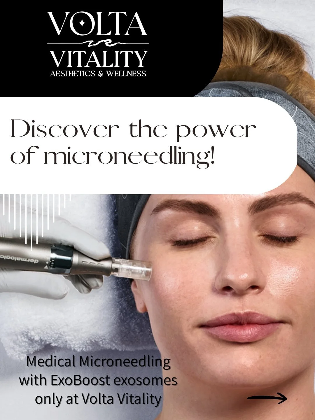 ✨Medical Microneedling&hellip;Now at Volta Vitality ✨

Medical microneedling allows us to go deeper than traditional microneedling when appropriate, for corrective skin regeneration - literally triggering new structural support, accelerated turnover 
