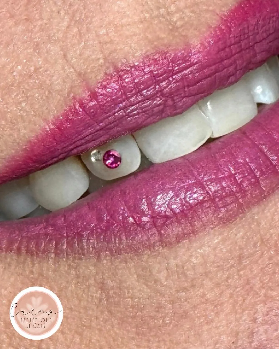 𝐂𝐡𝐢𝐜. 𝐄́𝐭𝐢𝐧𝐜𝐞𝐥𝐚𝐧𝐭. 𝑺𝒘𝒂𝒓𝒐𝒗𝒔𝒌𝒊.✨

Ajoute une touche glamour &agrave; ton look avec un 𝐛𝐢𝐣𝐨𝐮 𝐝𝐞𝐧𝐭𝐚𝐢𝐫𝐞 d&eacute;licat et tendance.

Pos&eacute;s avec soin, &agrave; l&rsquo;aide de produits professionnels et 100 % s&ea