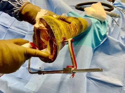 DARWIN aiming device in place.jpg