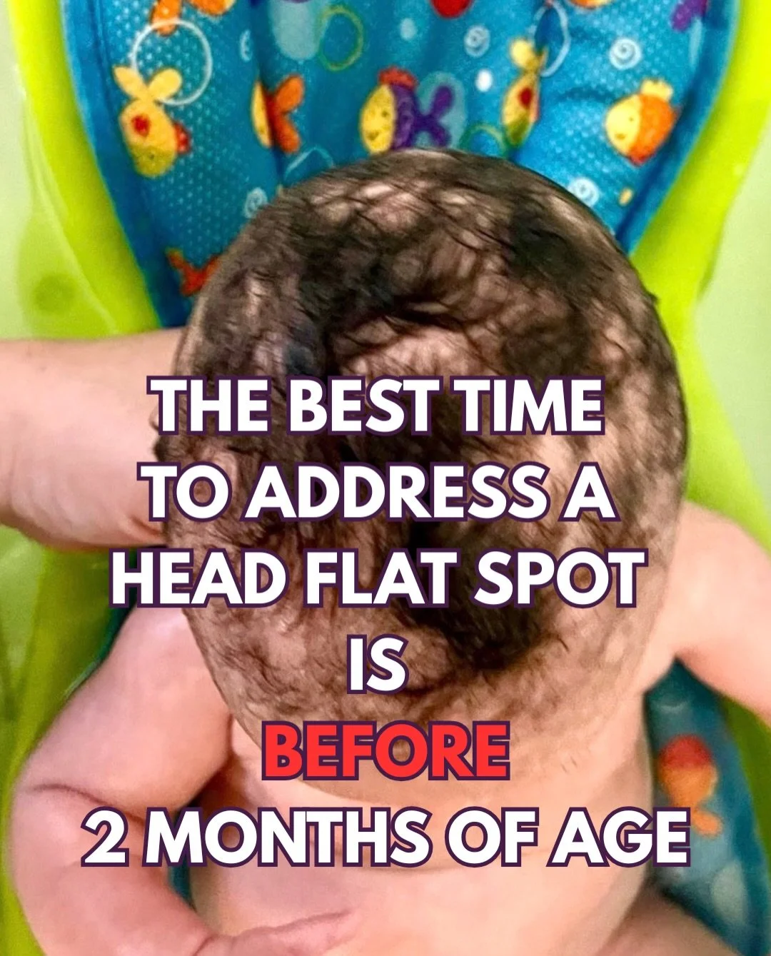 What I wish every parent knew about head flat spots 

✨The best time to get a referral for PT is at the first sign of a flat spot. Starting therapy after 4 months of age increases length of treatment, and likelihood of needing other interventions suc