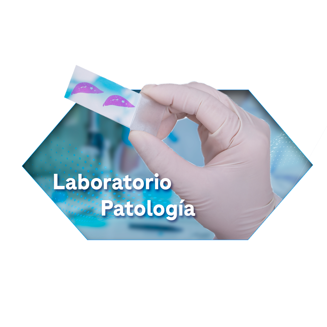 Lab%252Bpatologi%2525CC%252581a.png