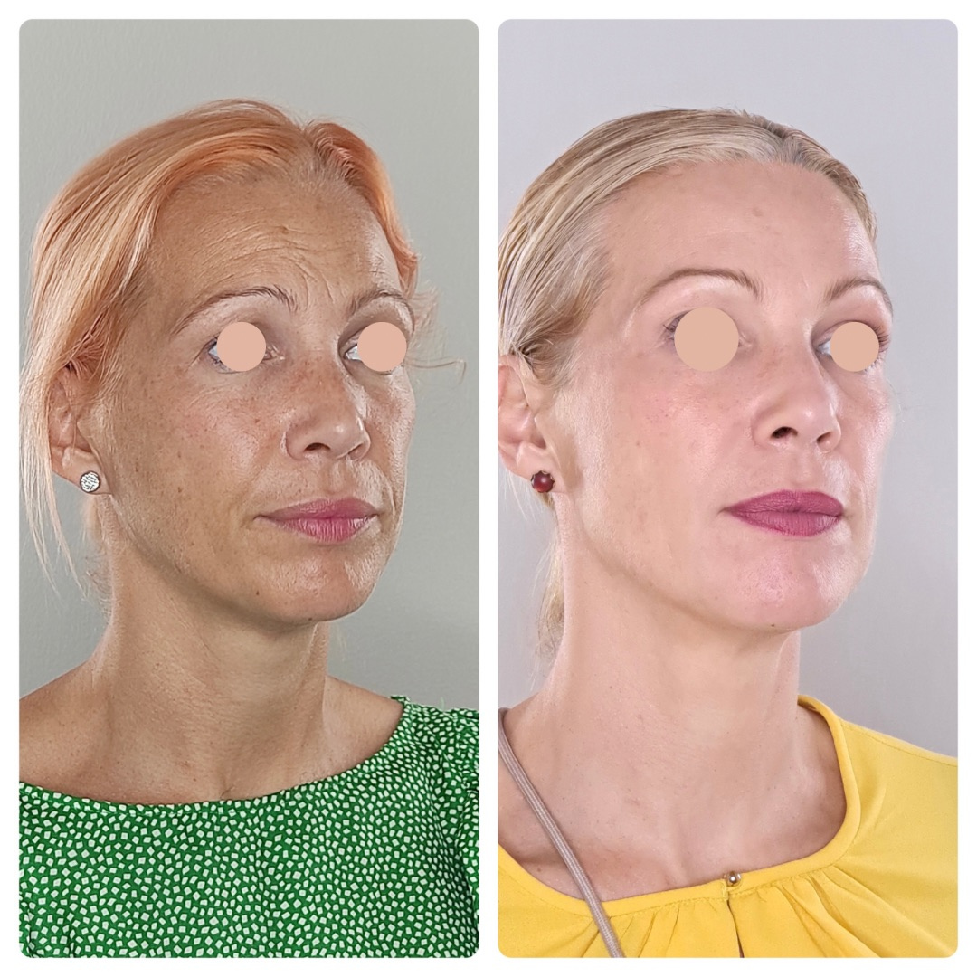 Cuidado facial mujer antimanchas 
