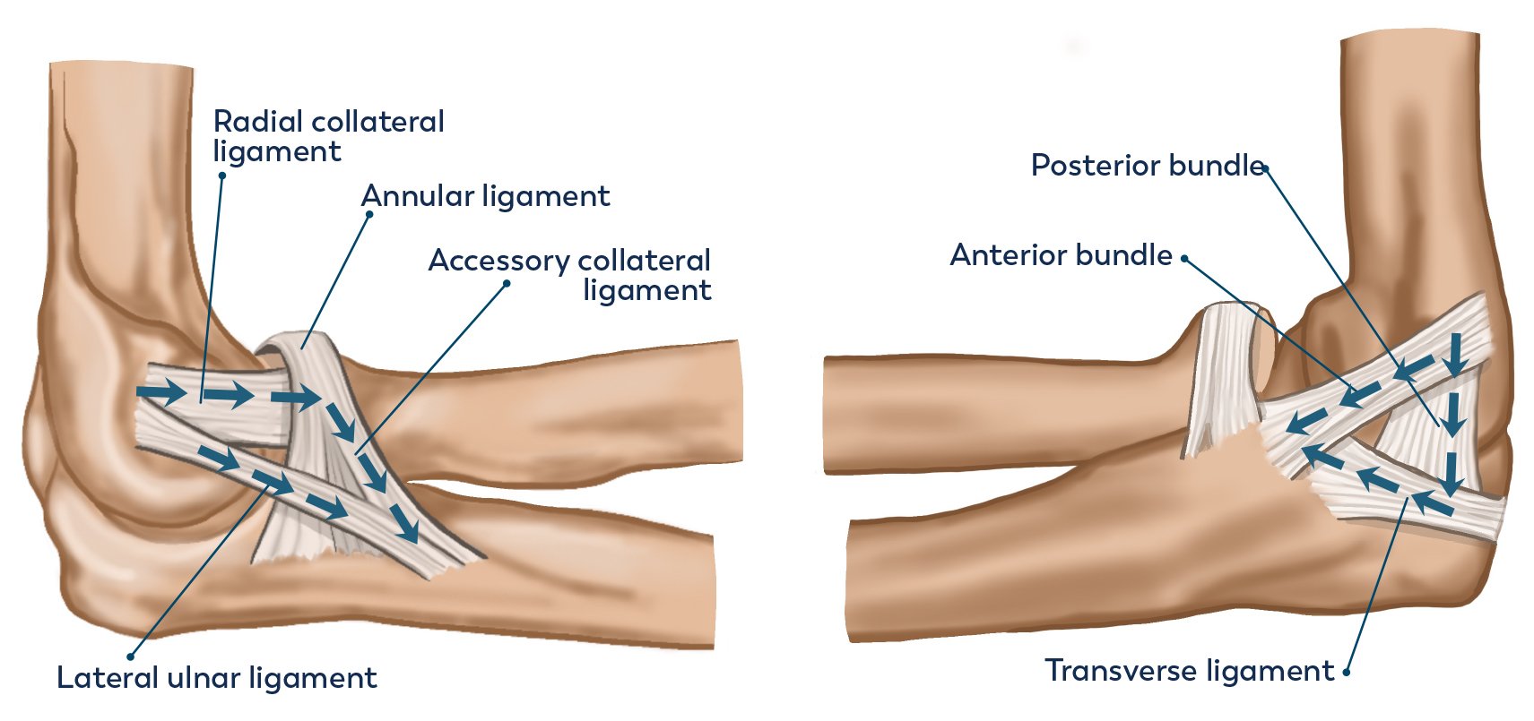 Elbow Instability – Collateral ligament injury — Dr Jeevaka (Jay ...