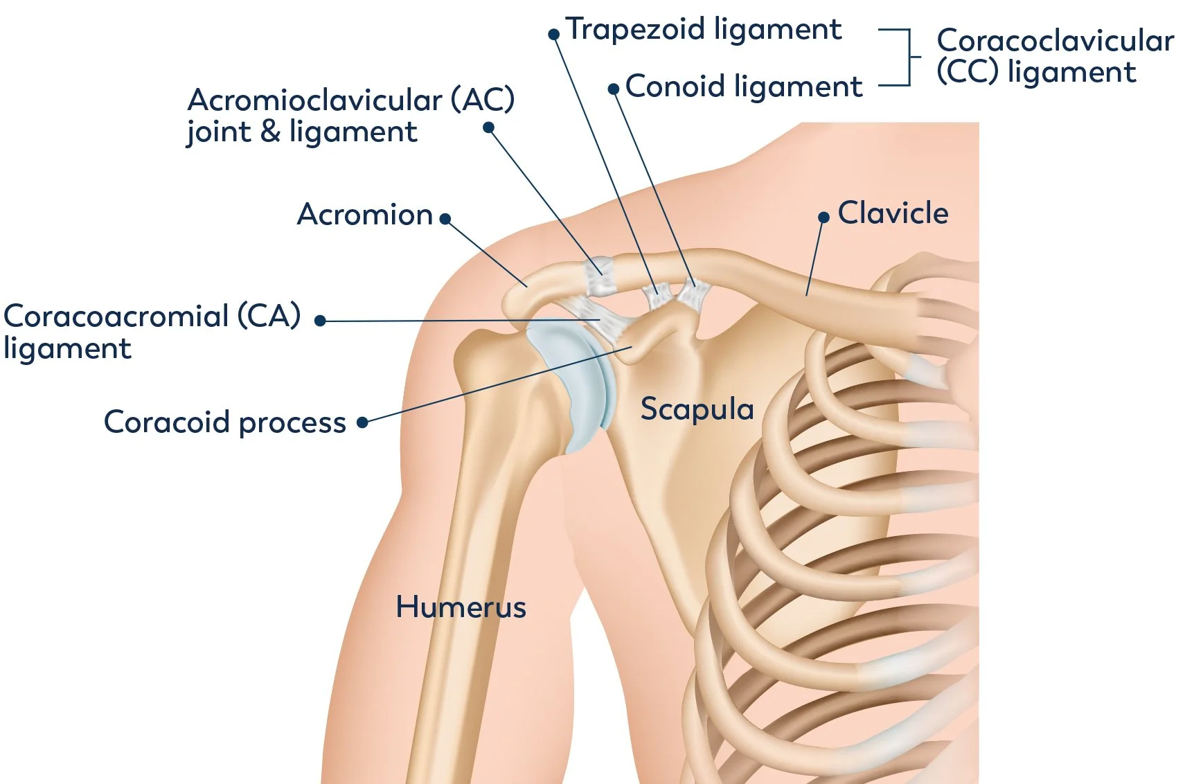 Acj Should R Acromioclavicular Joint Injuries — Dr Jeevaka (Jay) Amaranath ...