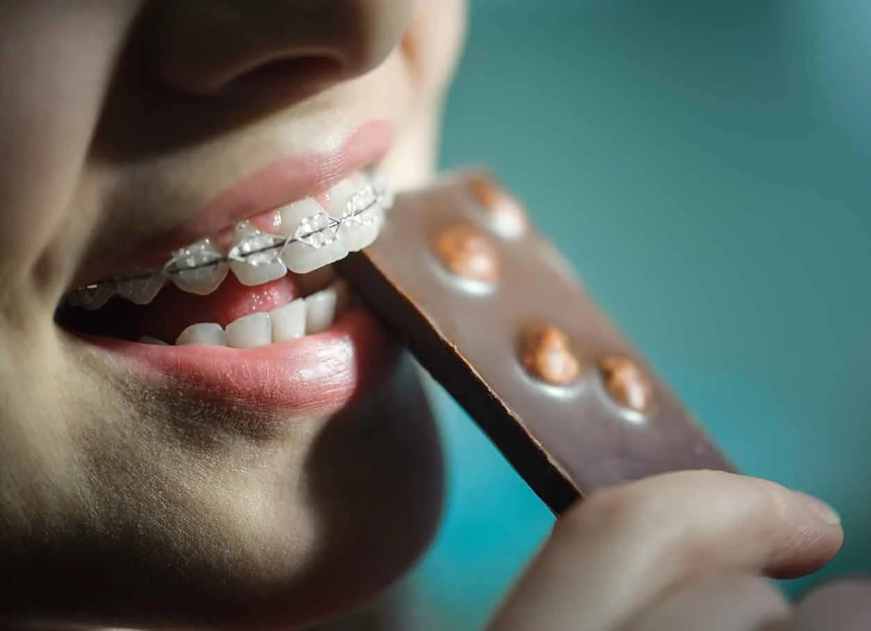 Do Braces Hurt? Tips And Advice On How To Stop Braces Pain