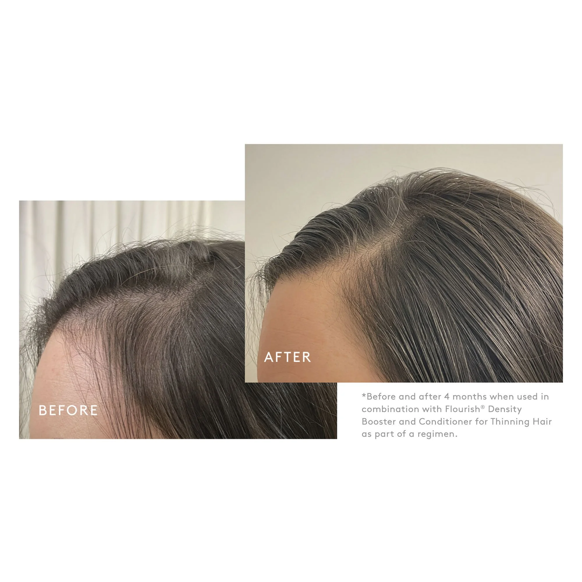 817023025442-BEFOREAFTER-3.jpg