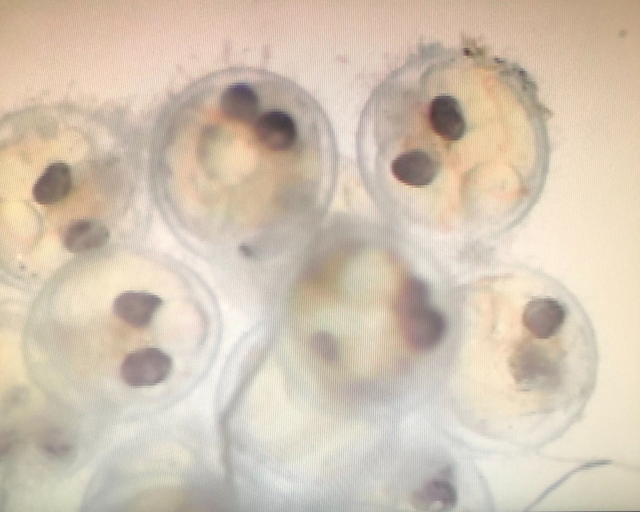 Fish embryos (developed fish eggs) seen through a microscope in Aquatic Omics Lab at Ontario Tech University 