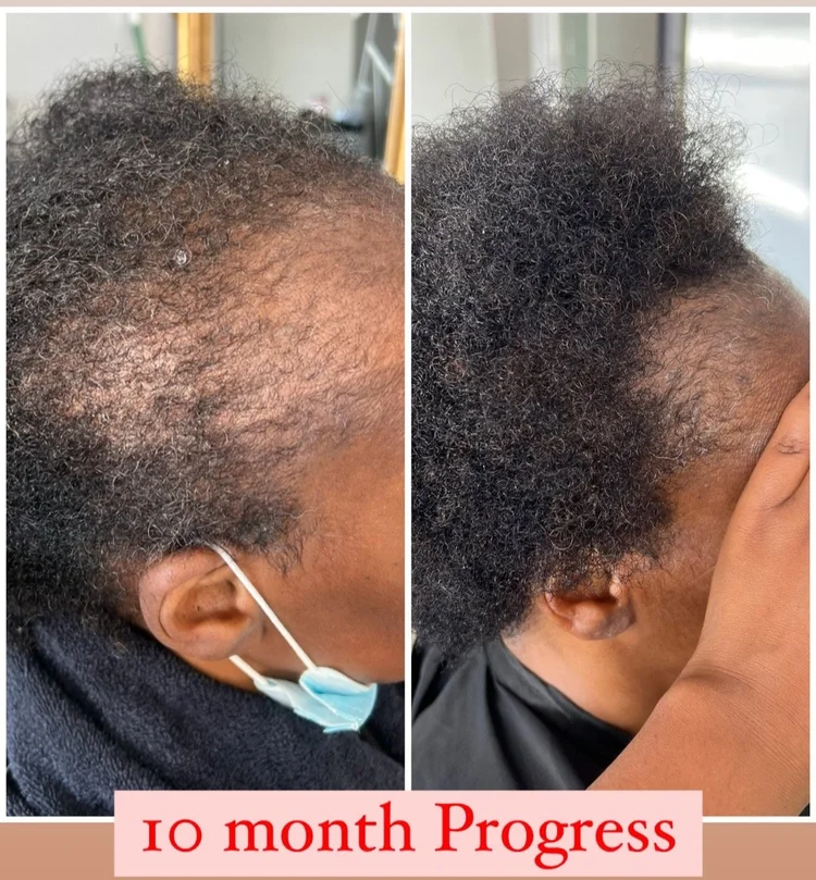 HairJones411 Hair Clinic business photo