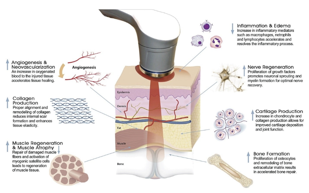 Low Level Laser Therapy