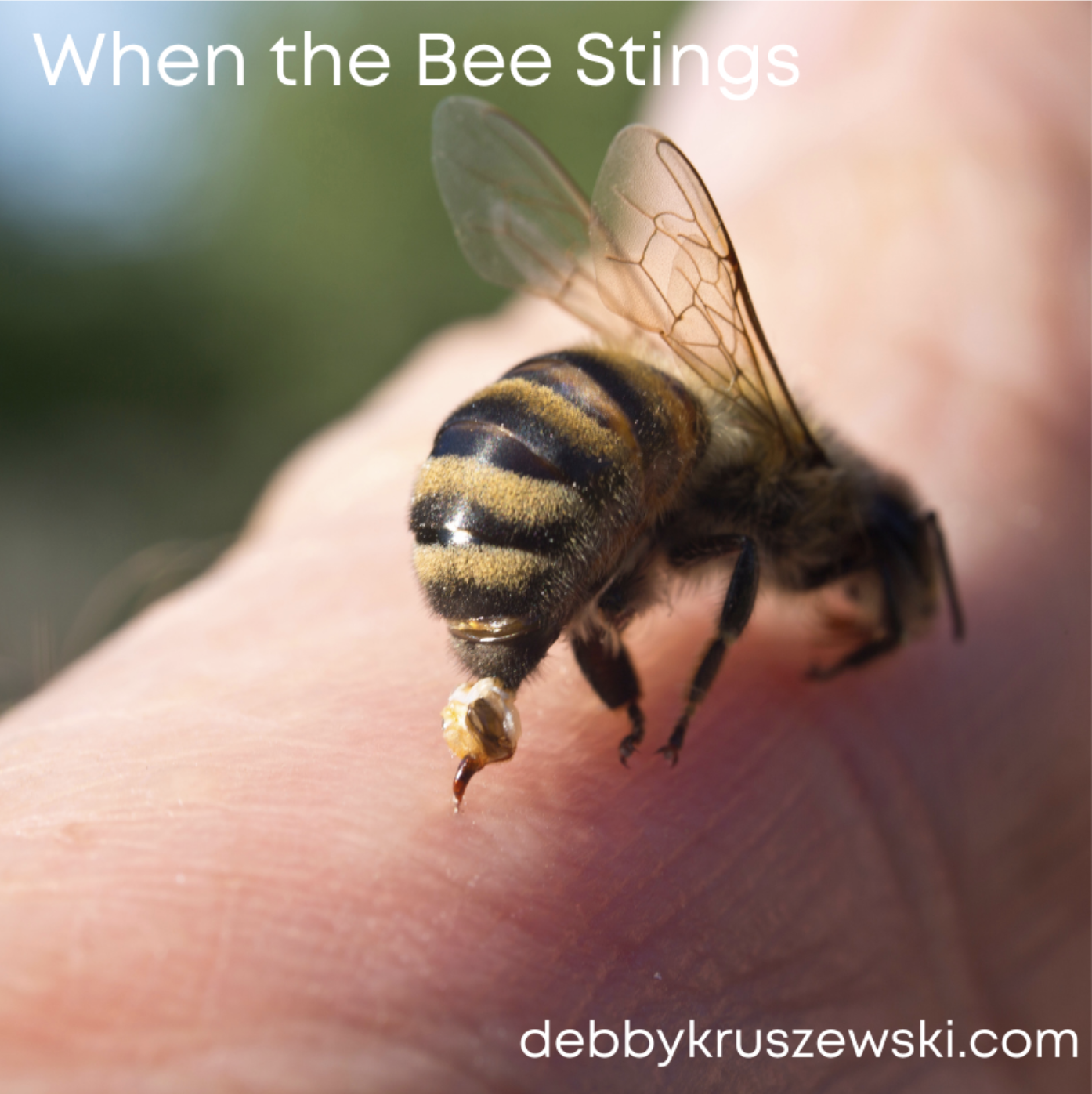 When the Bee Stings