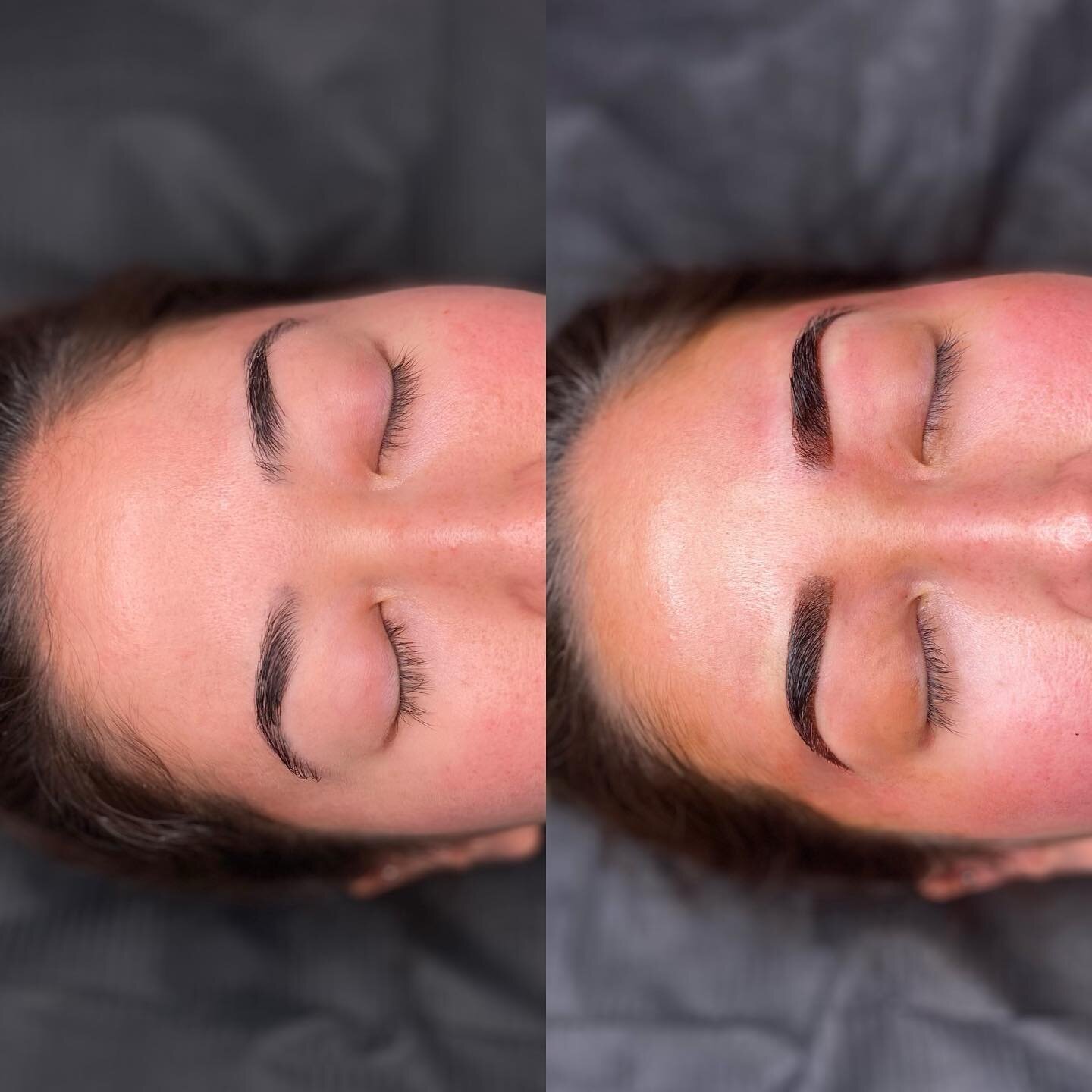 Ombr&eacute; Brows by Natalie 🔥

Ombr&eacute; brows is a semi-permanent eyebrow tattoo technique that uses a small machine to place extremely thin dots of pigment into the skin, creating a soft-shaded brow pencil look. If you are over pencilling in 