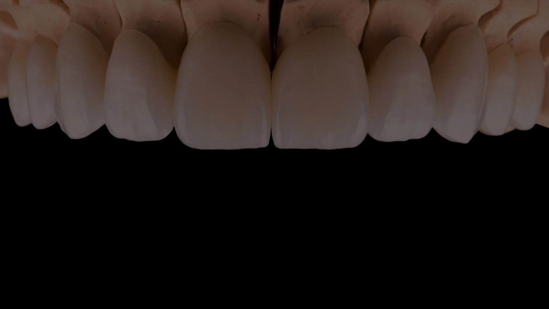Sarasola Dental