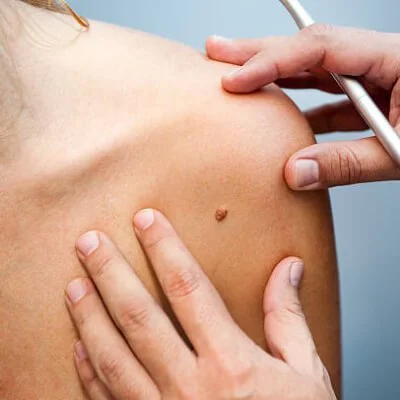 Surgical Dermatology