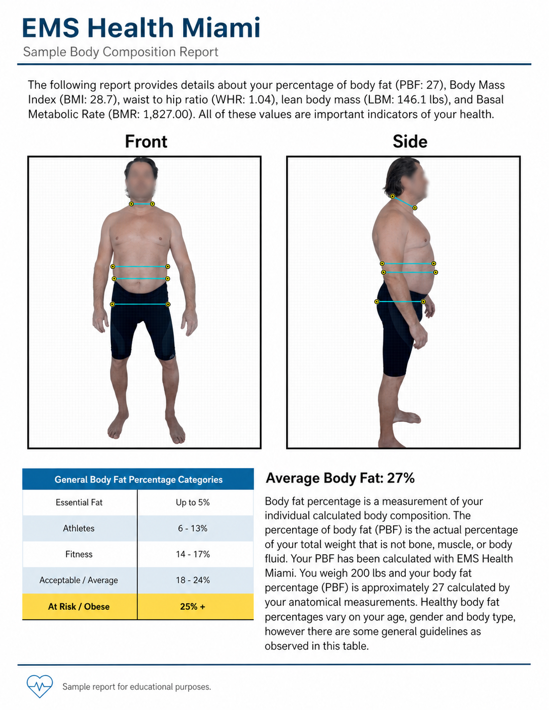 EMS Health Miami Body Composition Visual Report