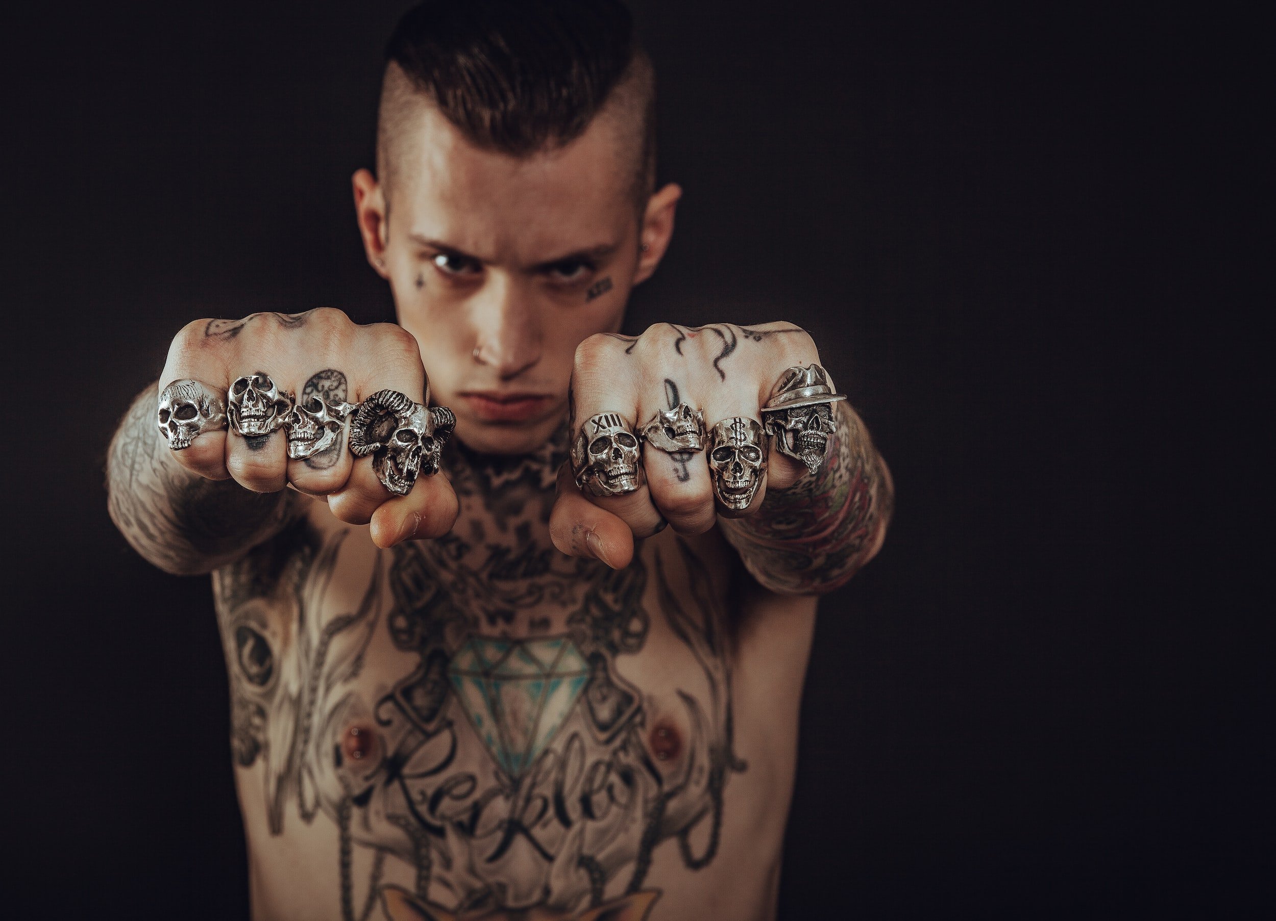 Can All Tattoos Be Removed? 6 Things You Should Know - Dr Nathan Holt