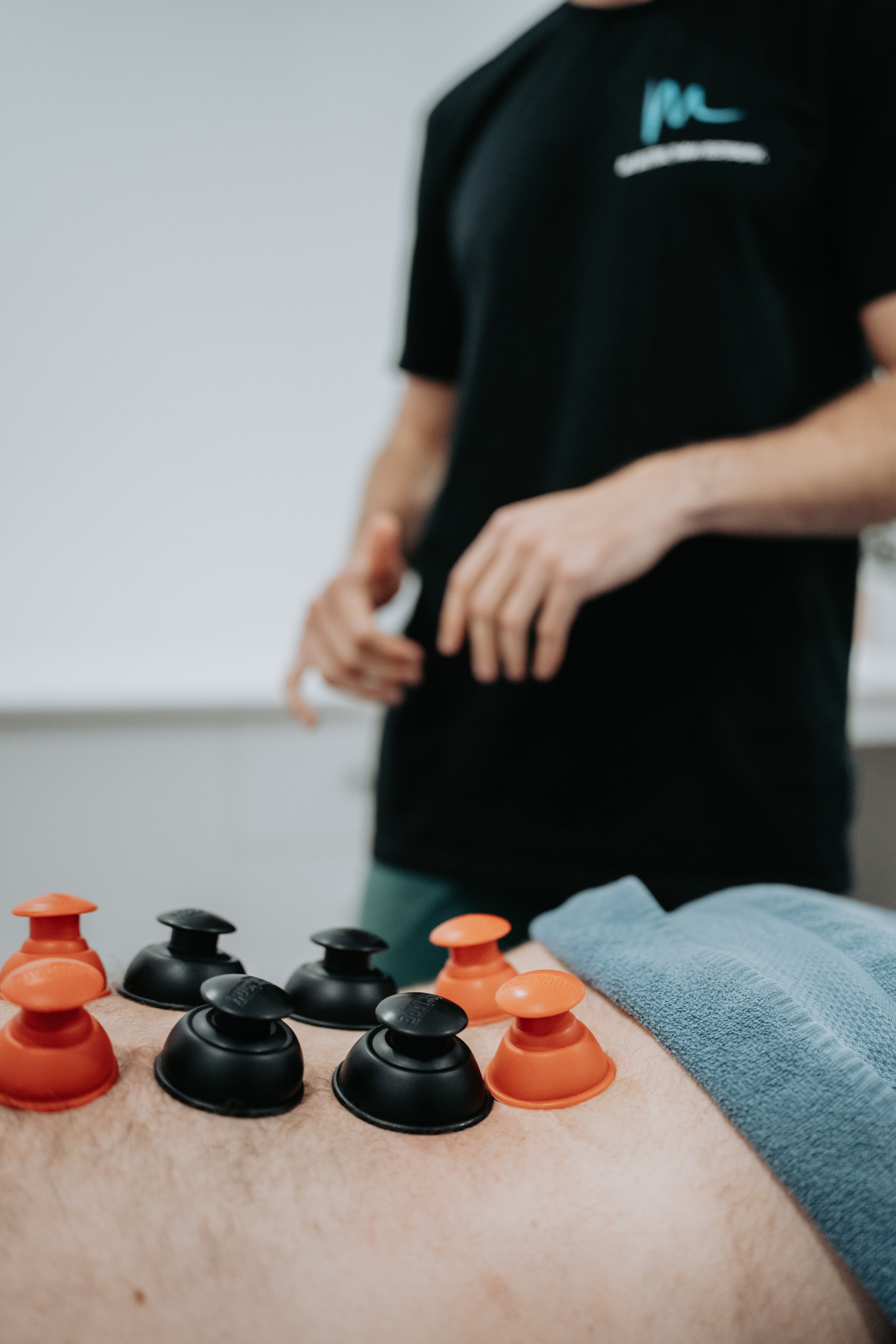 Cupping Therapy: What Is It and How Can It Help Your Recovery?