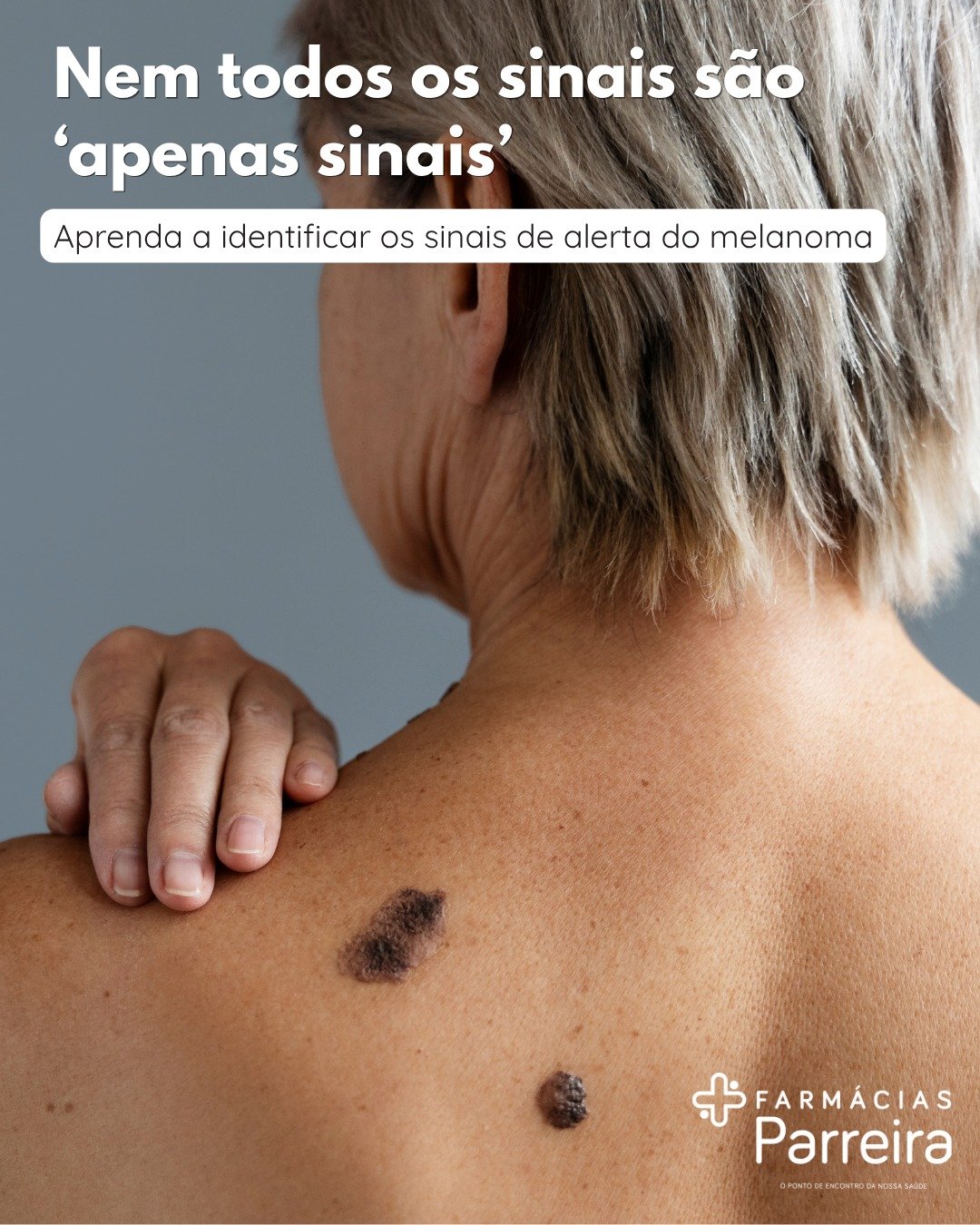 Maio &eacute; o M&ecirc;s do Euromelanoma ☀️
Na Farm&aacute;cia Parreira, refor&ccedil;amos a import&acirc;ncia da preven&ccedil;&atilde;o e da dete&ccedil;&atilde;o precoce do cancro da pele.

A nossa pele tem mem&oacute;ria &mdash; e cuidar dela ho