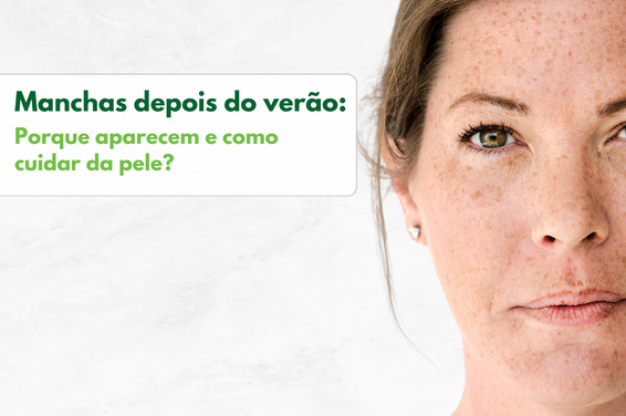 Manchas depois do verão: porque aparecem e como cuidar da pele?