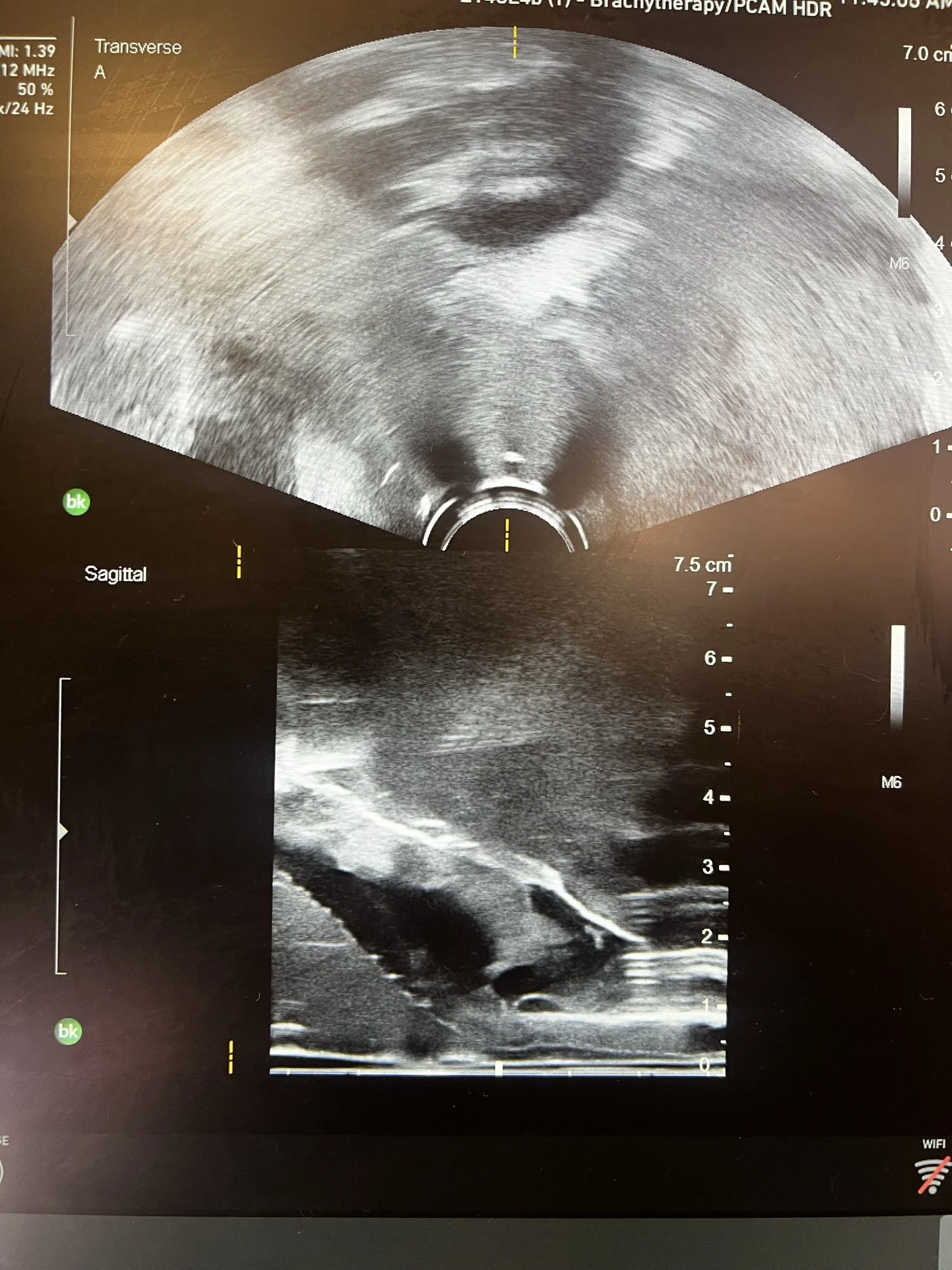 Ultrasound imaging of Viomerse's synthetic OB GYN pelvis training model.