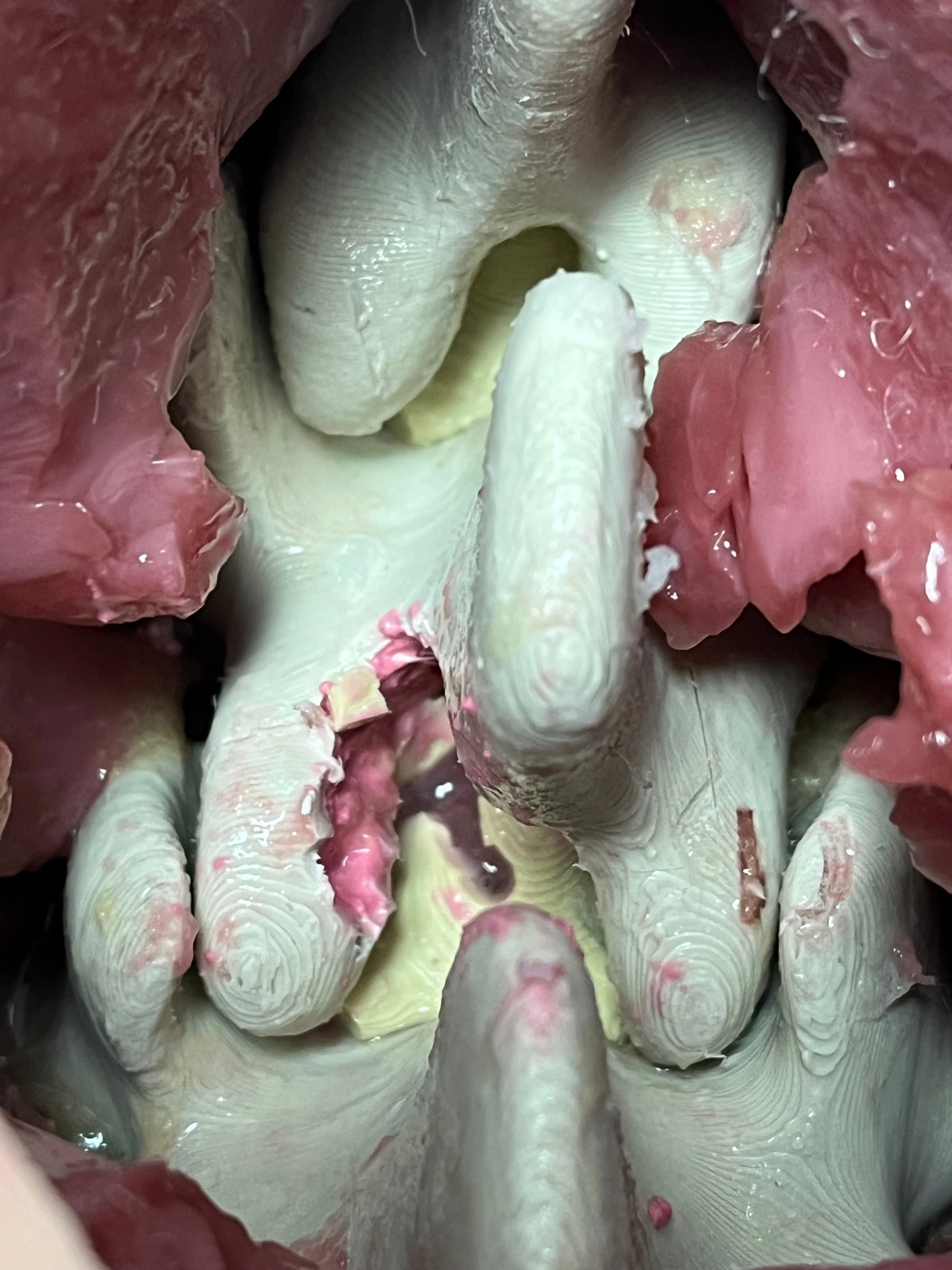 Neuromodulation L1-T6 Inside 2.jpg