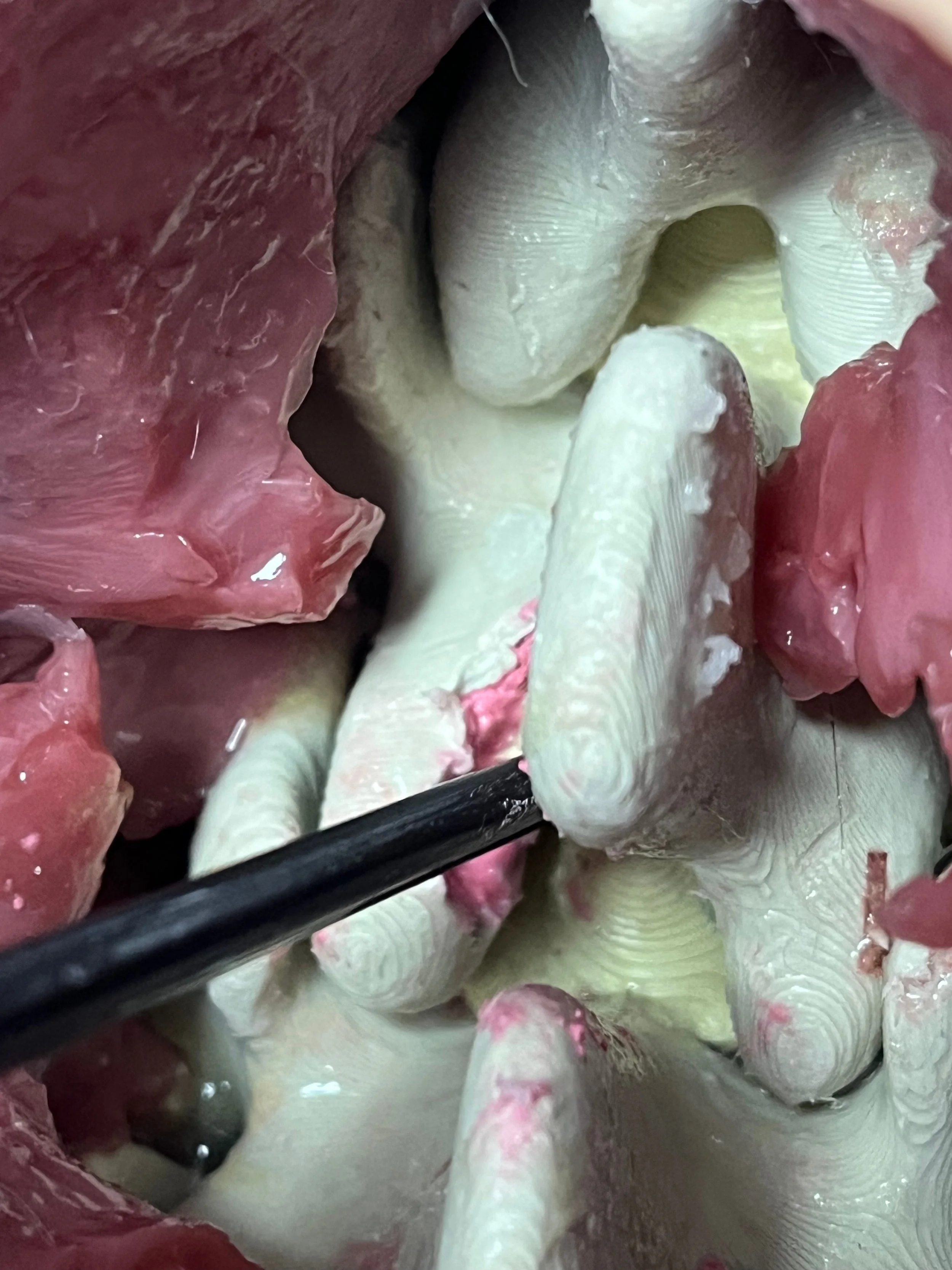 Close-up of Viomerse's Thoracolumbar spine training model consisting of L1 to T6, dissected with realistic bone and tissue