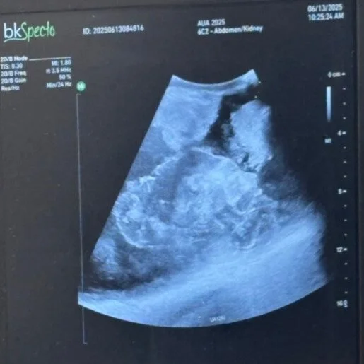 Ultrasound image of Viomerse's synthetic kidney pathology training model phantom.