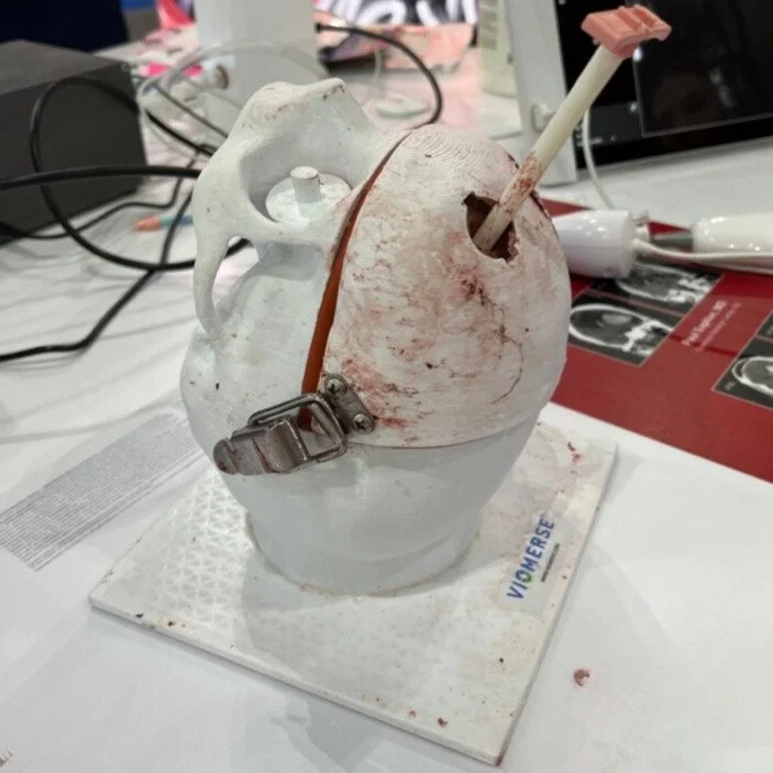 Intracerebral hemorrhage synthetic brain training model with refillable blood clots.