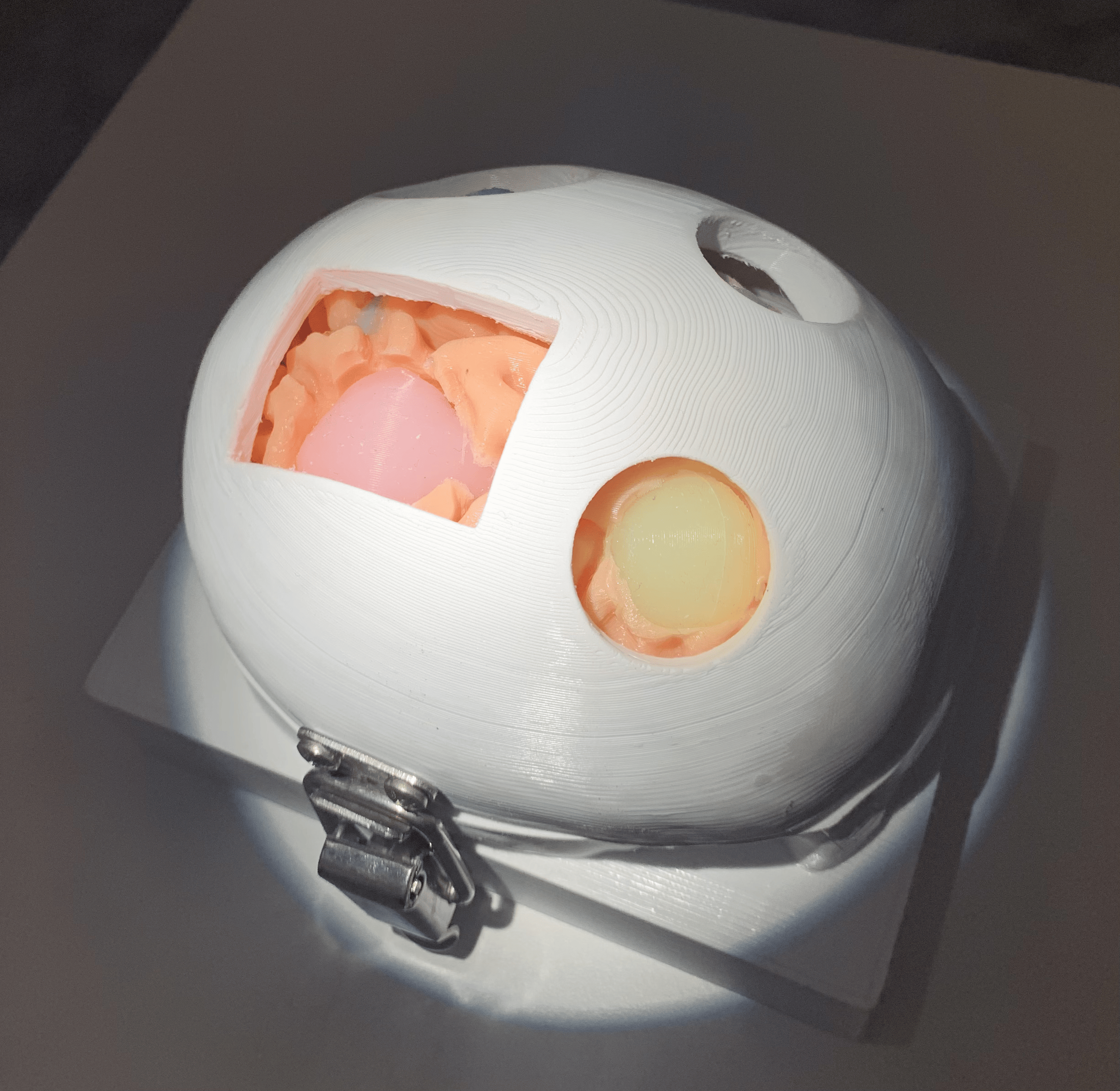 Non-resectable Cortical Brain Tumor Phantom.png