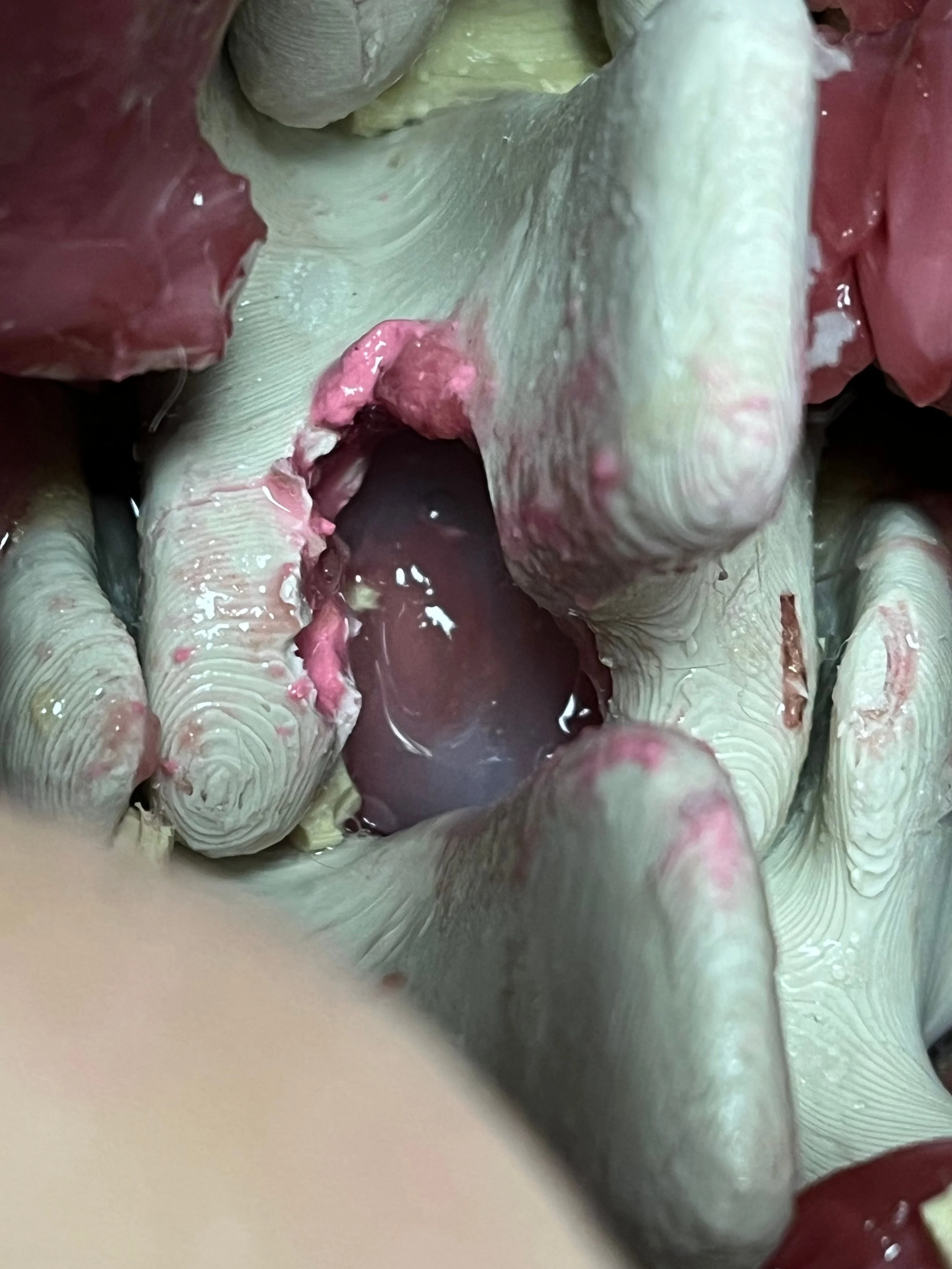 Neuromodulation L1-T6 Inside 3.jpg