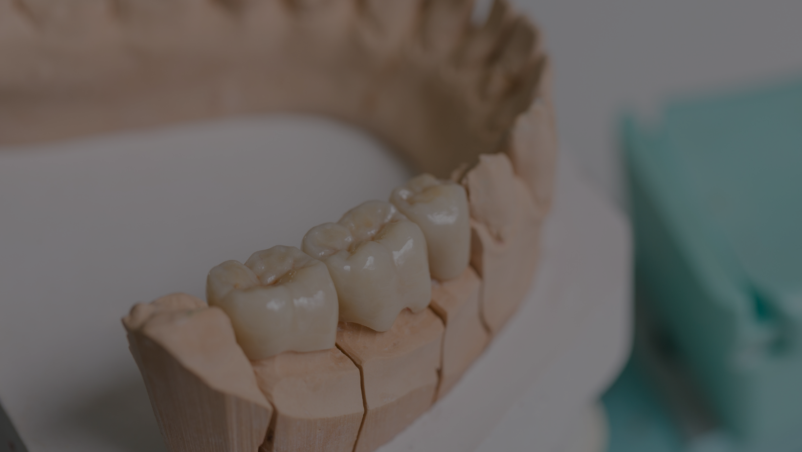 Precision Dental Restoration Full Service Dental Laboratory