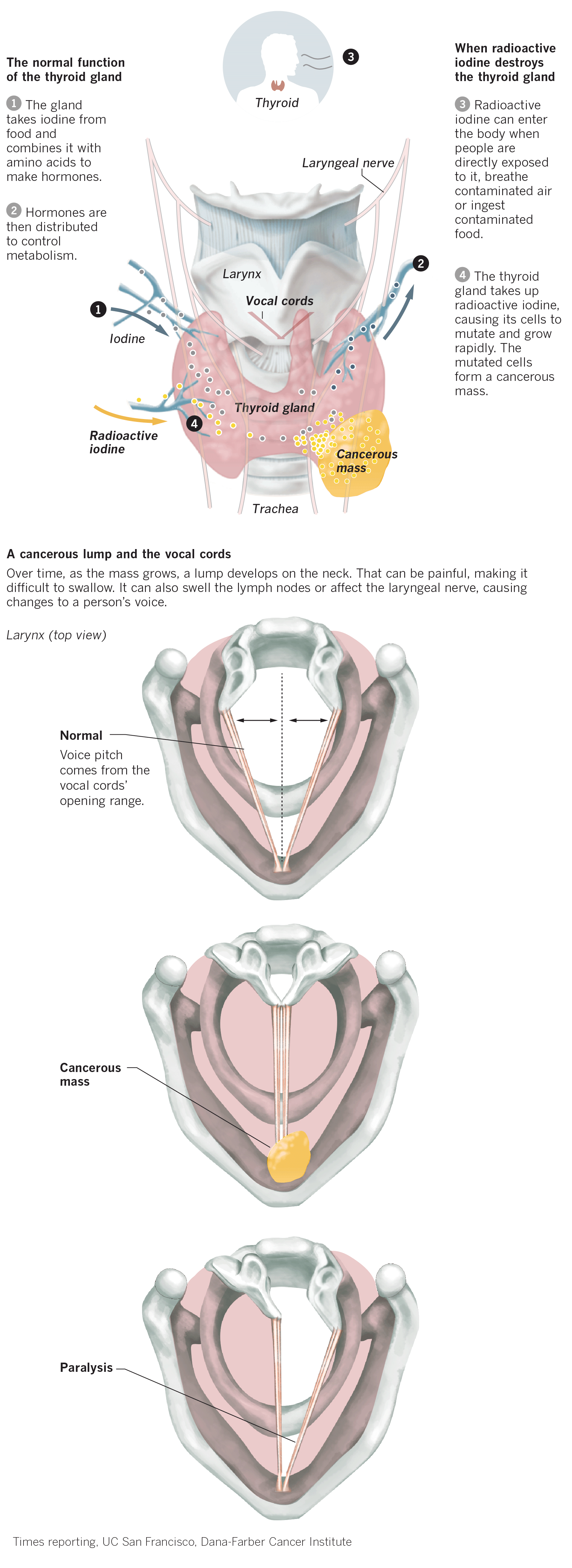460067-w1-la-na-marshall-islands-thyroid-DT.png