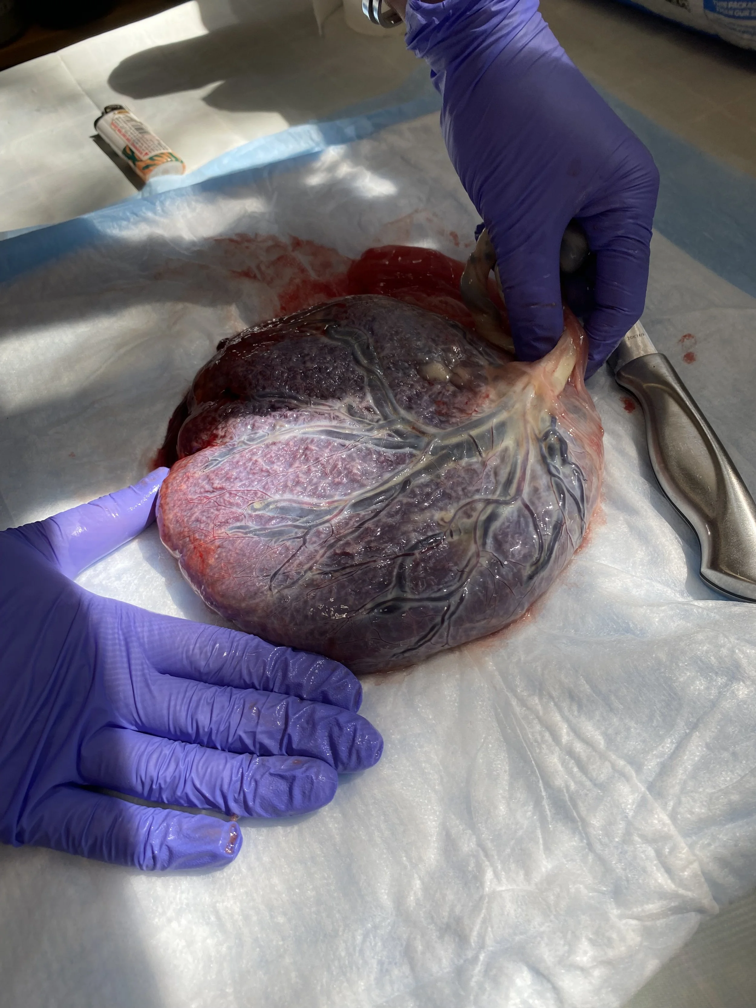 A fresh placenta framed by two hands in purple gloves. The placenta is photographed before it is steamed for a placenta encapsulation.
