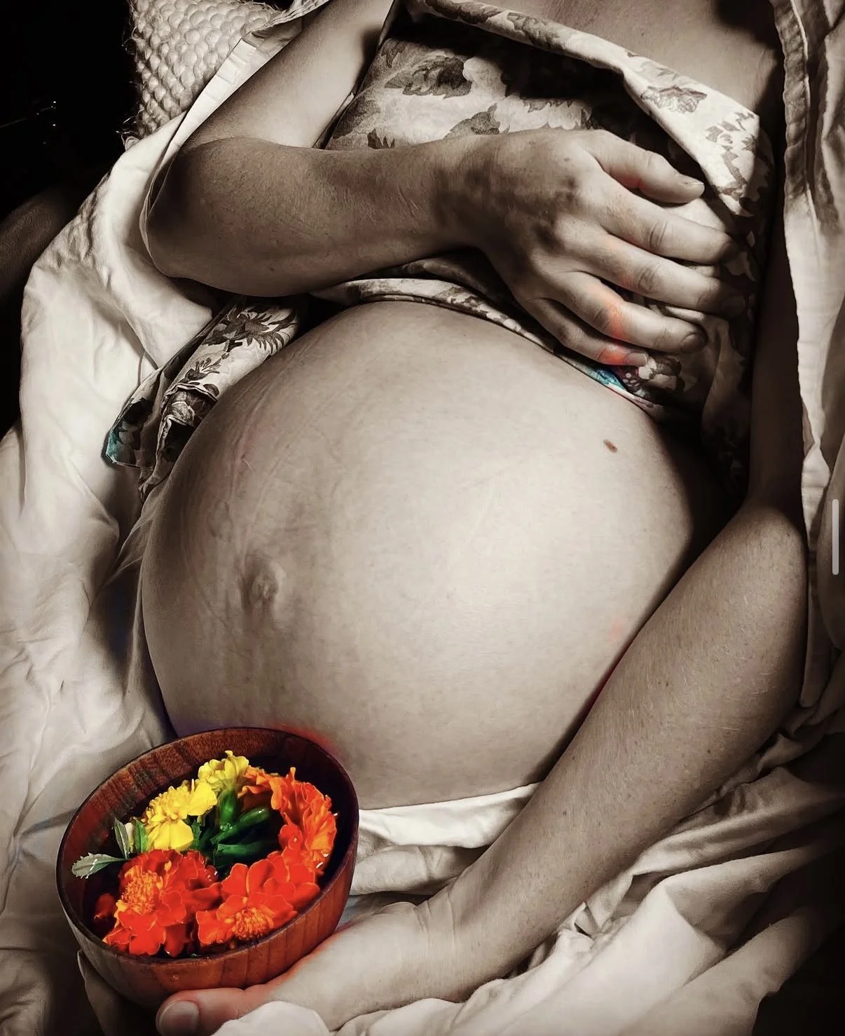 Resolution of Idiopathic Infertility&nbsp;