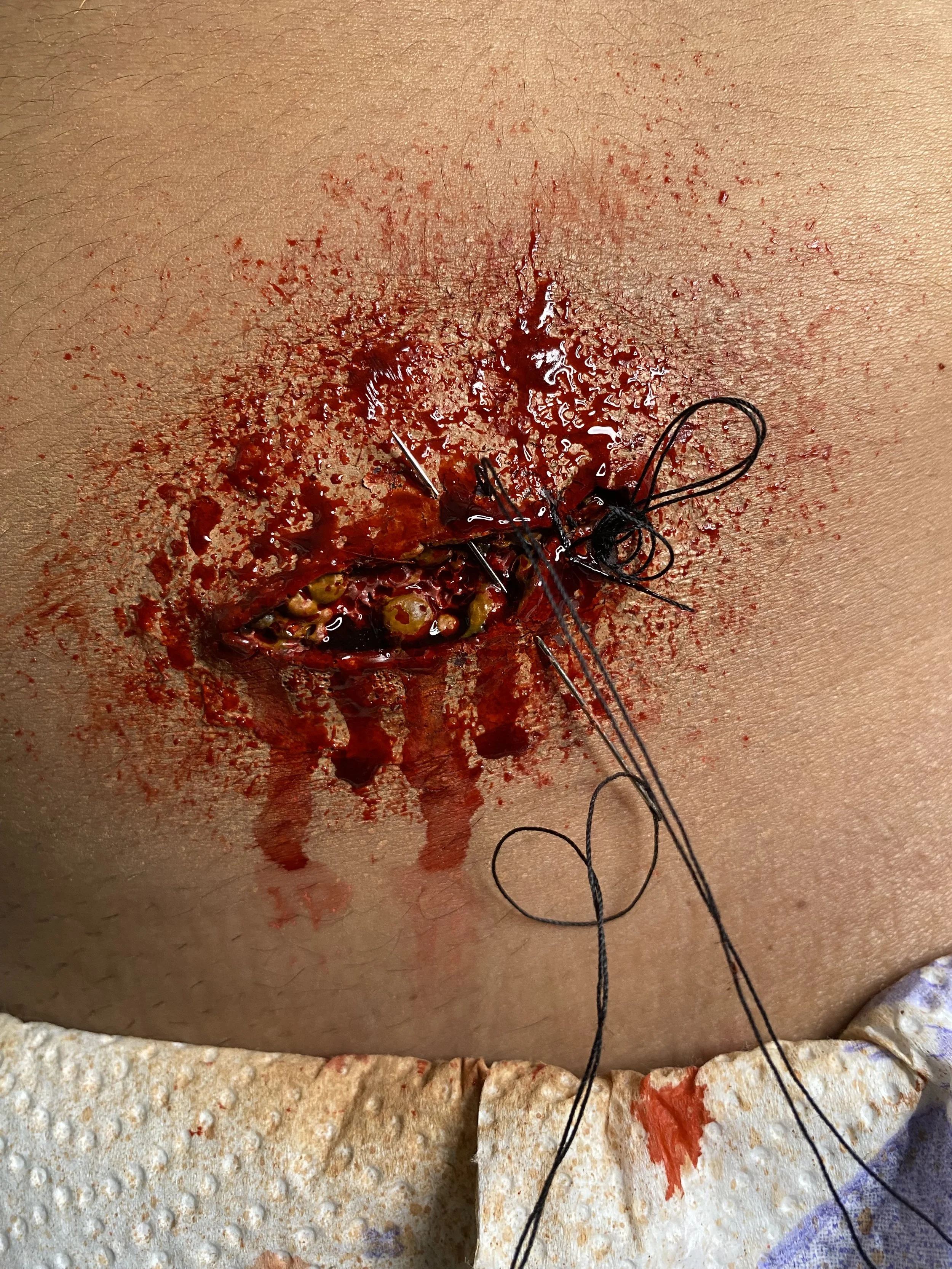 [2024] Silicone Wound made, painted and applied by Dimanek