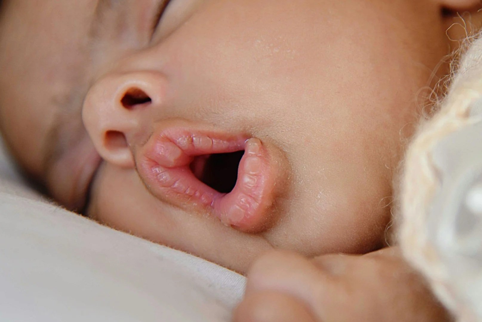 Who to See if You Suspect Your Infant Has a Tongue Tie
