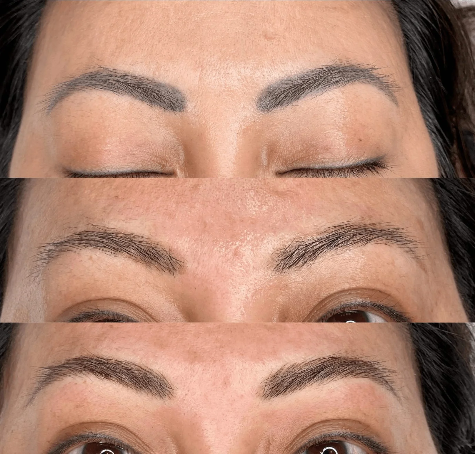 Laser eyebrow tattoo removal at the Surbiton studio
