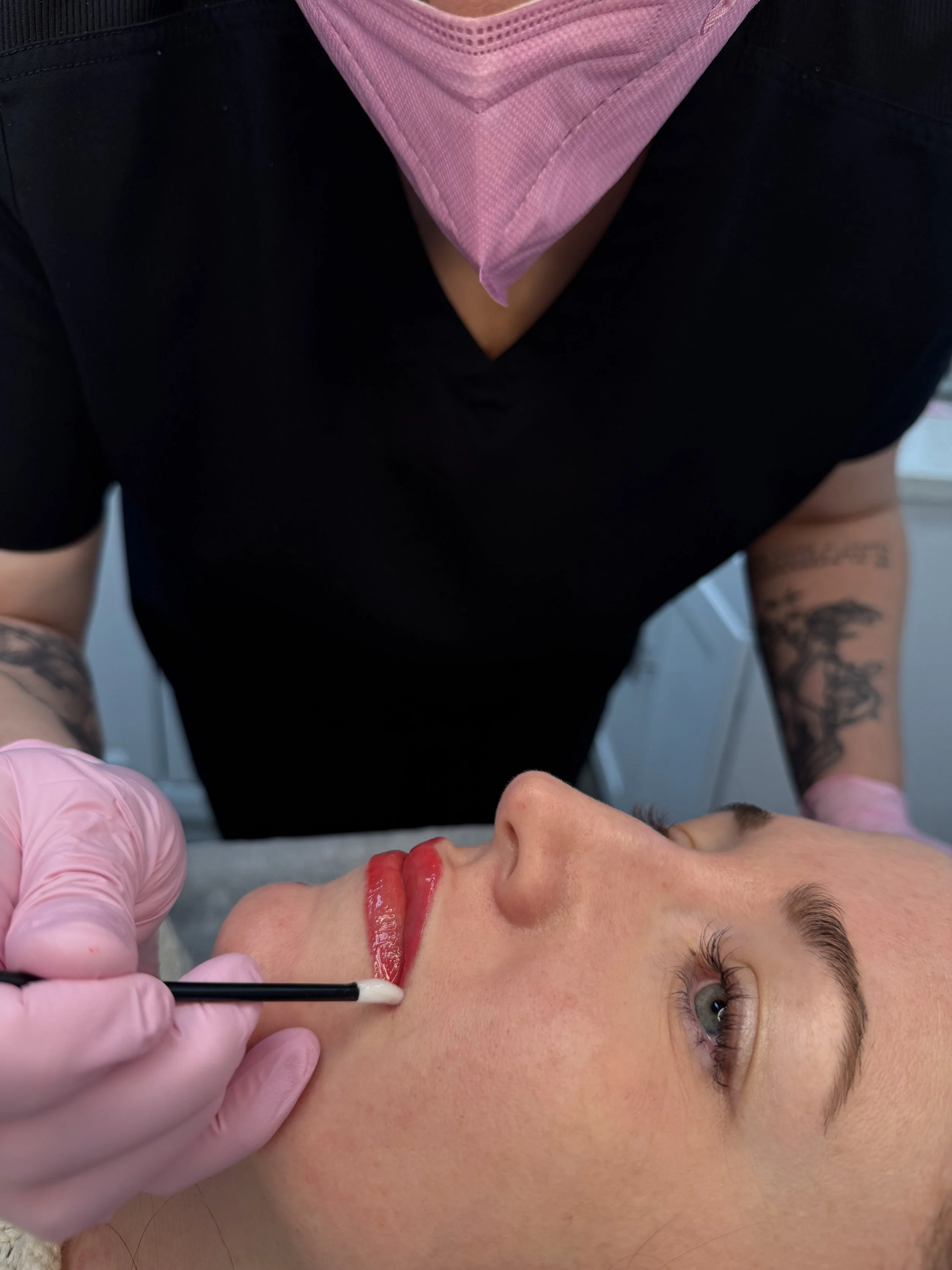 A woman receiving a cosmetic lip procedure, lying down with her eyes open, while a technician wearing pink gloves applying lip gloss or filler with a small brush.